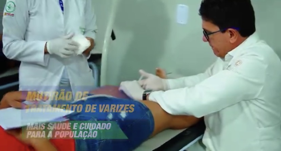 Prefeitura de Açailândia realiza mutirão com mais de 600 consultas e 150 procedimentos de tratamento de varizes